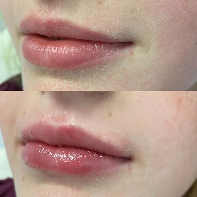 Before and after image