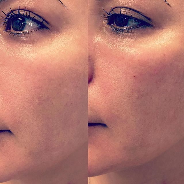 Before and after image