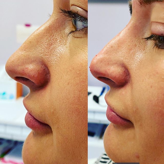 Before and after image