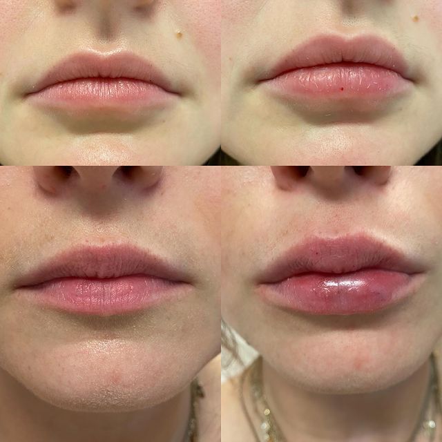 Before and after image