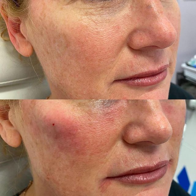 Before and after image