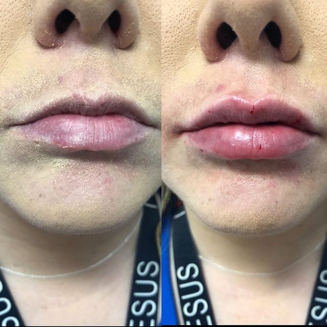 Before and after image