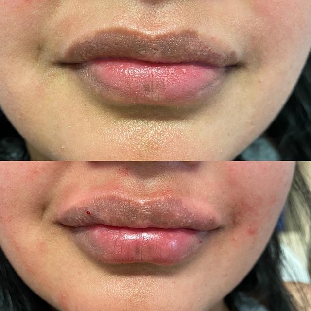 Before and after image