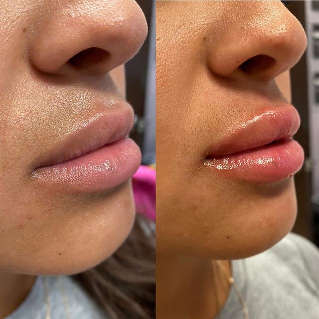 Before and after image