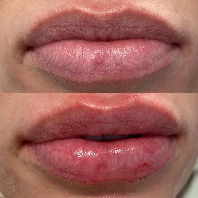 Before and after image