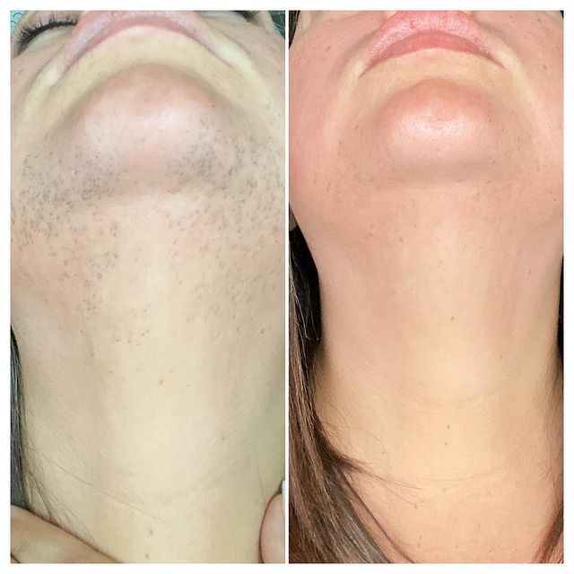 Before and after image