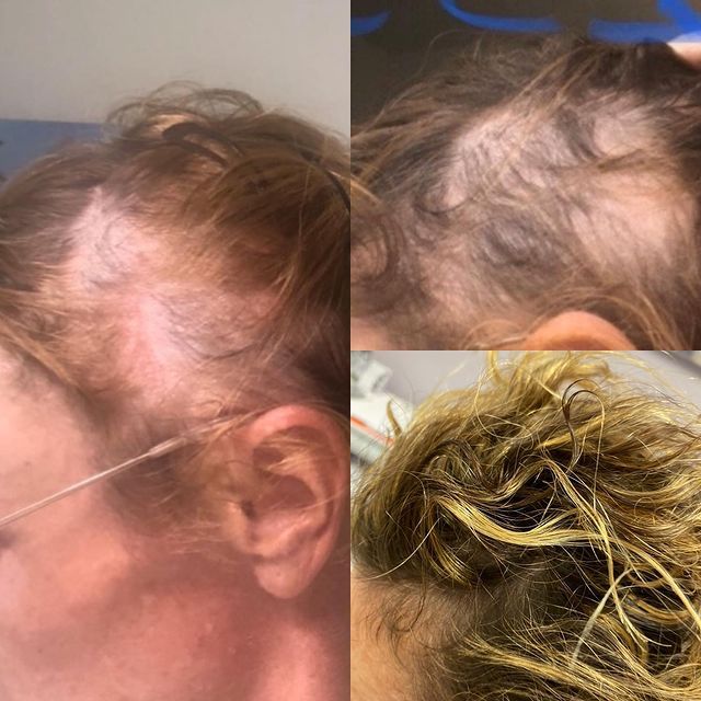 Before and after image