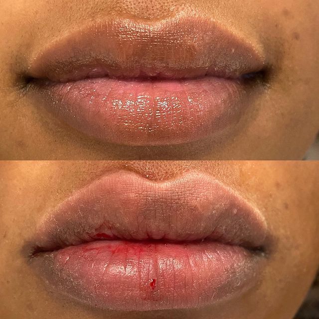 Before and after image