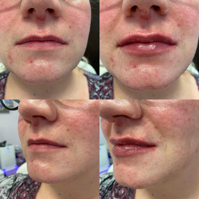 Before and after image