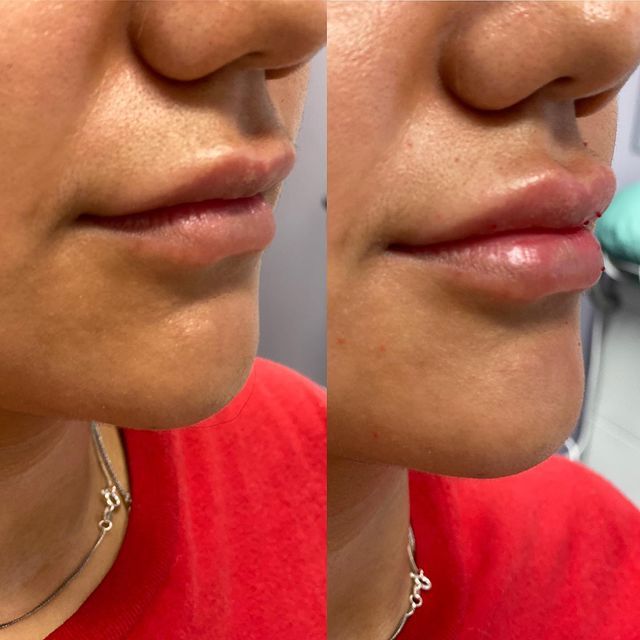 Before and after image