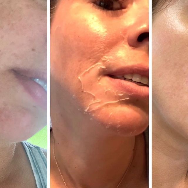 Before and after image