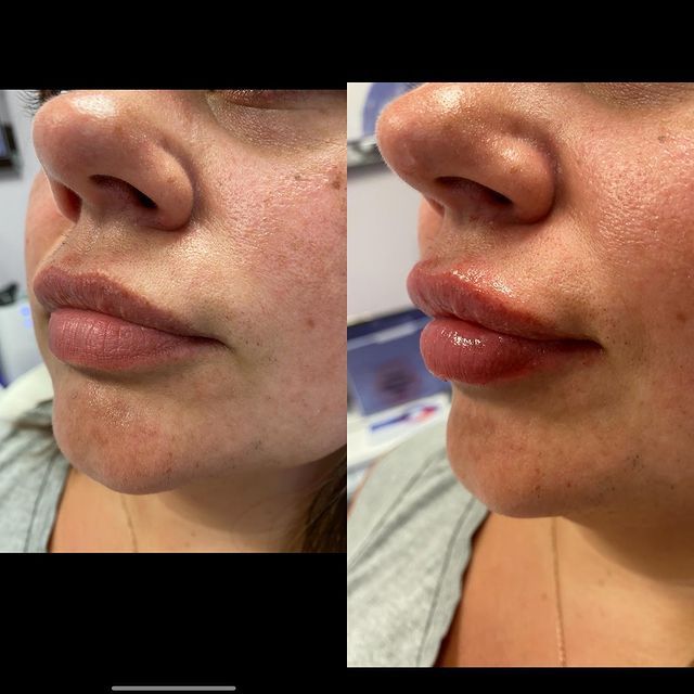 Before and after image