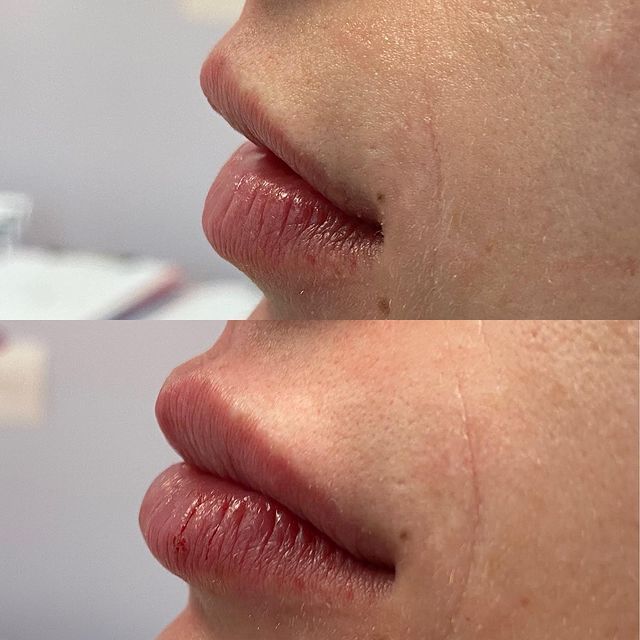 Before and after image