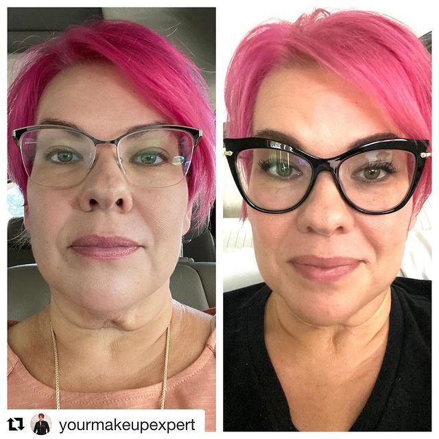 Before and after image