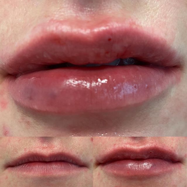 Before and after image