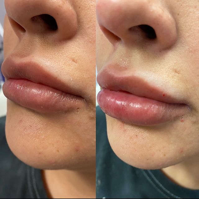 Before and after image