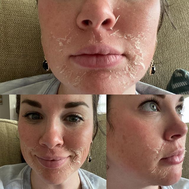 Before and after image