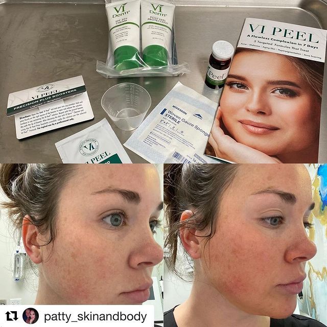 Before and after image