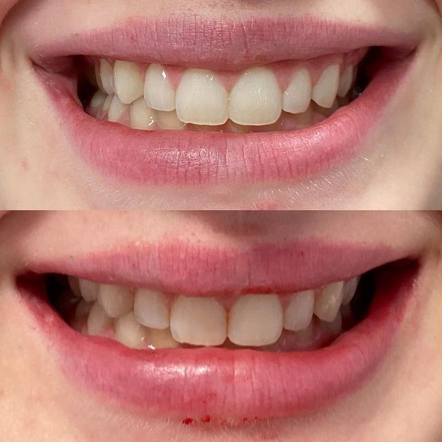 Before and after image