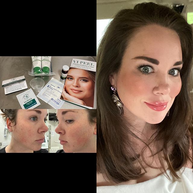 Before and after image