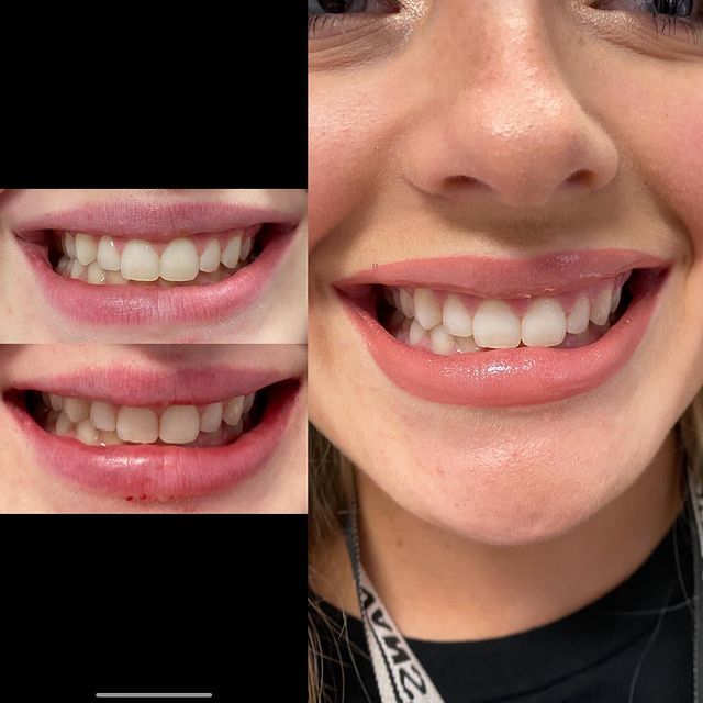 Before and after image