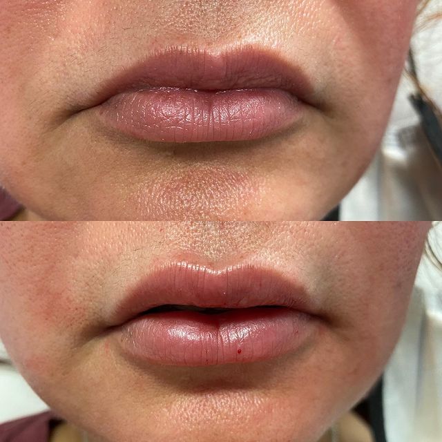 Before and after image