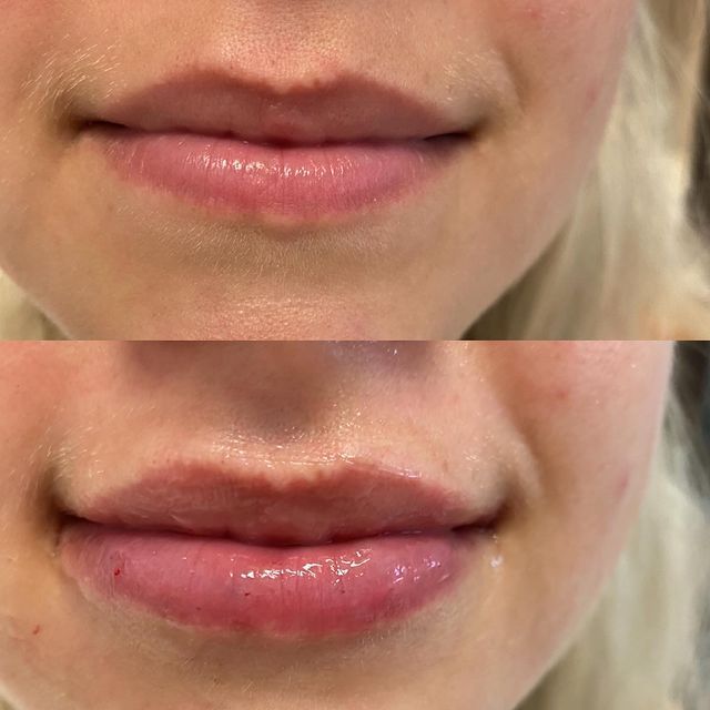 Before and after image