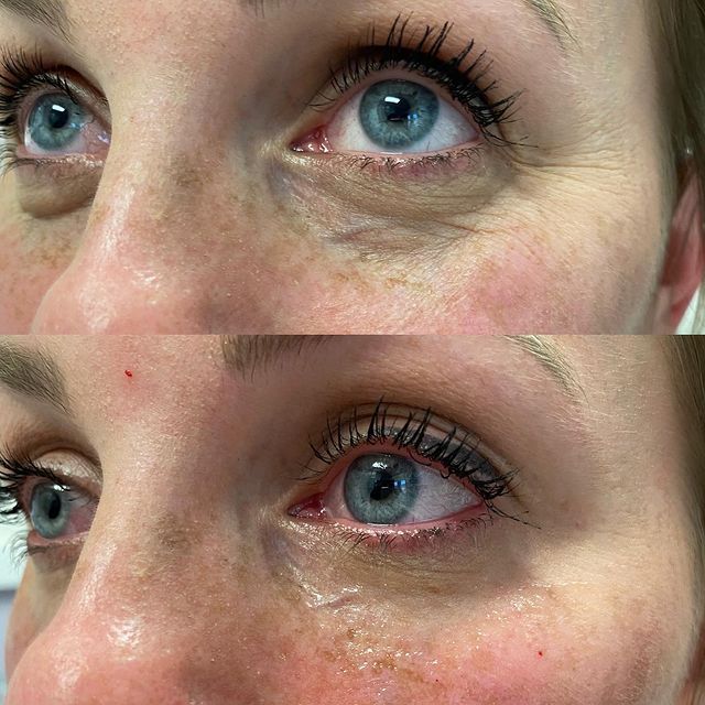 Before and after image