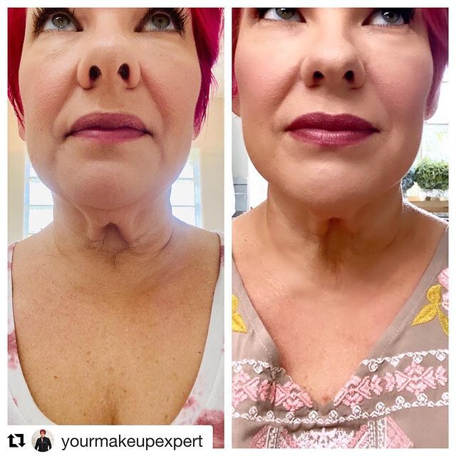 Before and after image