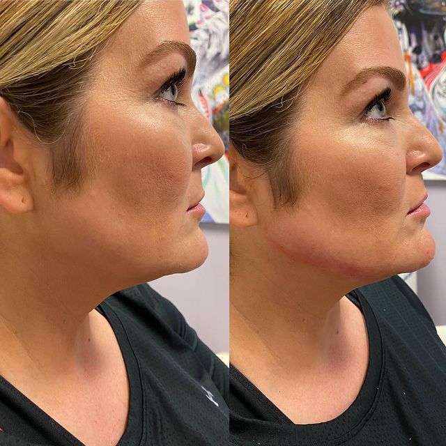 Before and after image