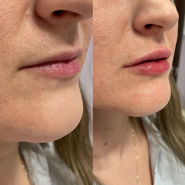 Before and after image