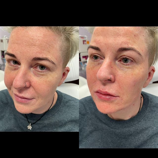 Before and after image