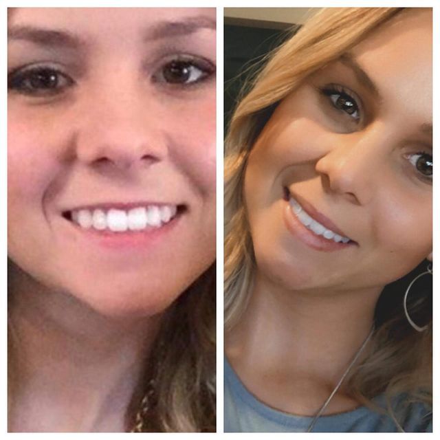 Before and after image