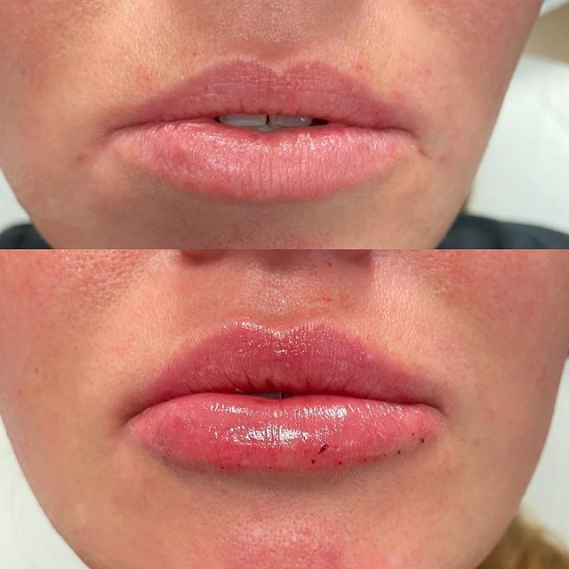 Before and after image