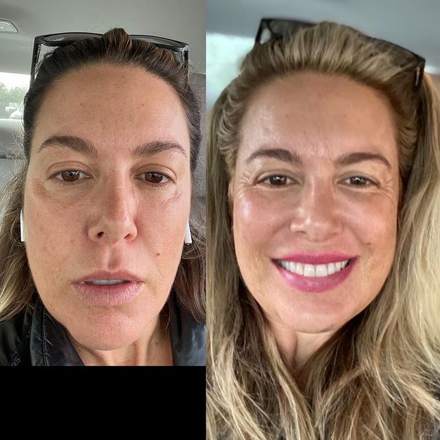 Before and after image