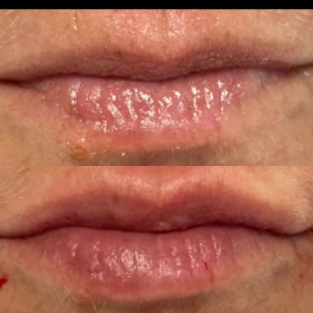 Before and after image