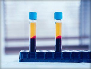 Blood samples on test tubes