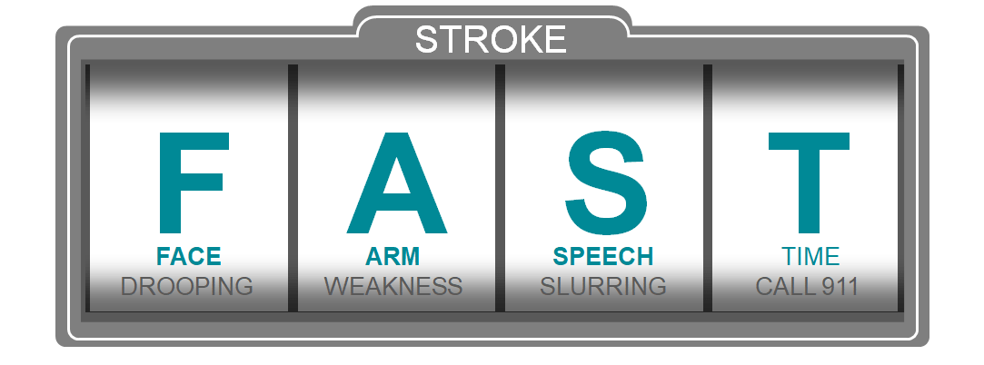 Signs and symptoms of stroke