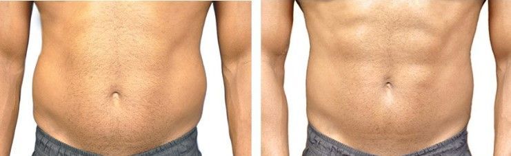 A before and after picture of a man's stomach.