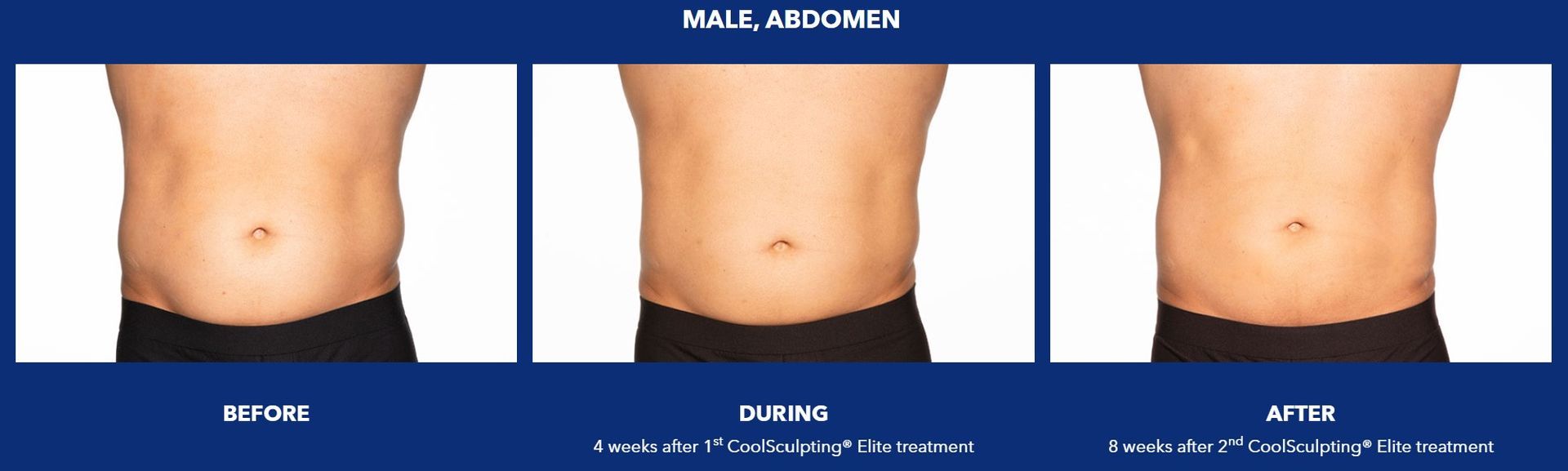 A before and after picture of a man's stomach