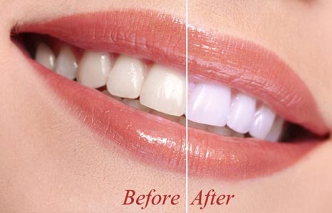 Learn More About Orthodontic Dentistry smile