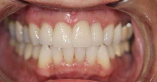 Close-up of a person's teeth. Bright, white teeth in a healthy mouth.