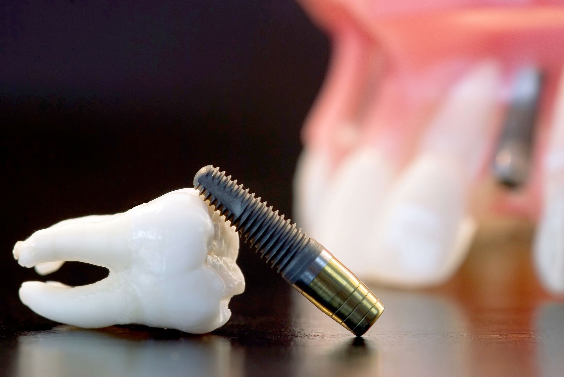 implant dentistry