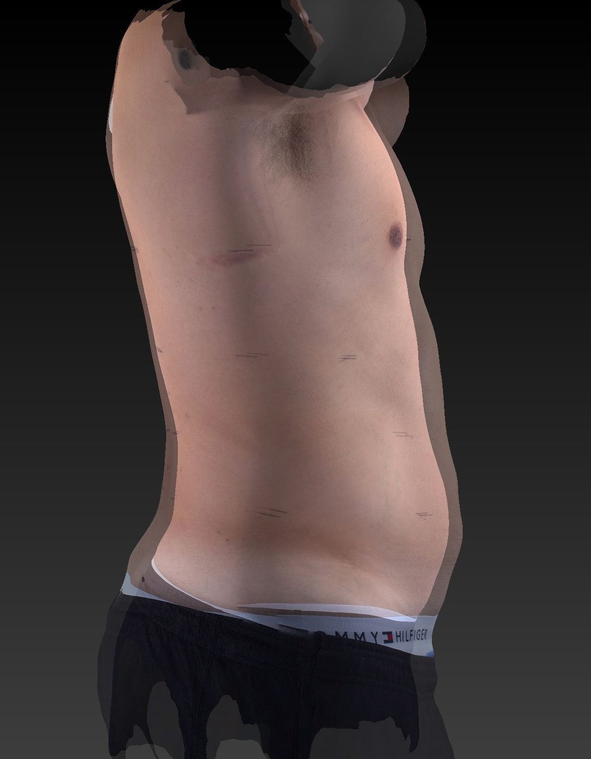 Before and after photo of a man who received an UltraSlim treatment