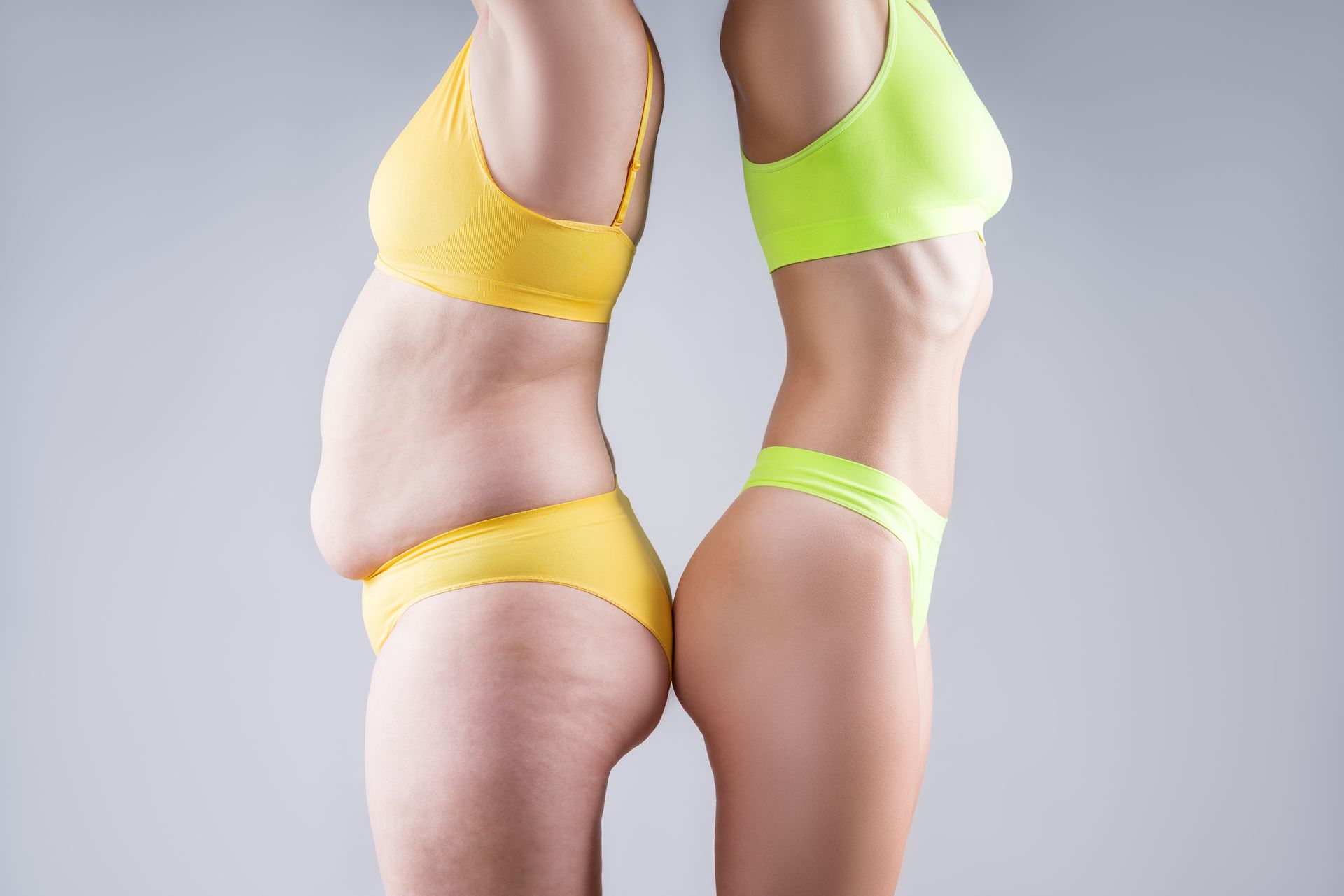 An overweight white woman wearing a yellow sports bra and underwear with her back up against a fit white woman who is wearing a green sports bra and underwear