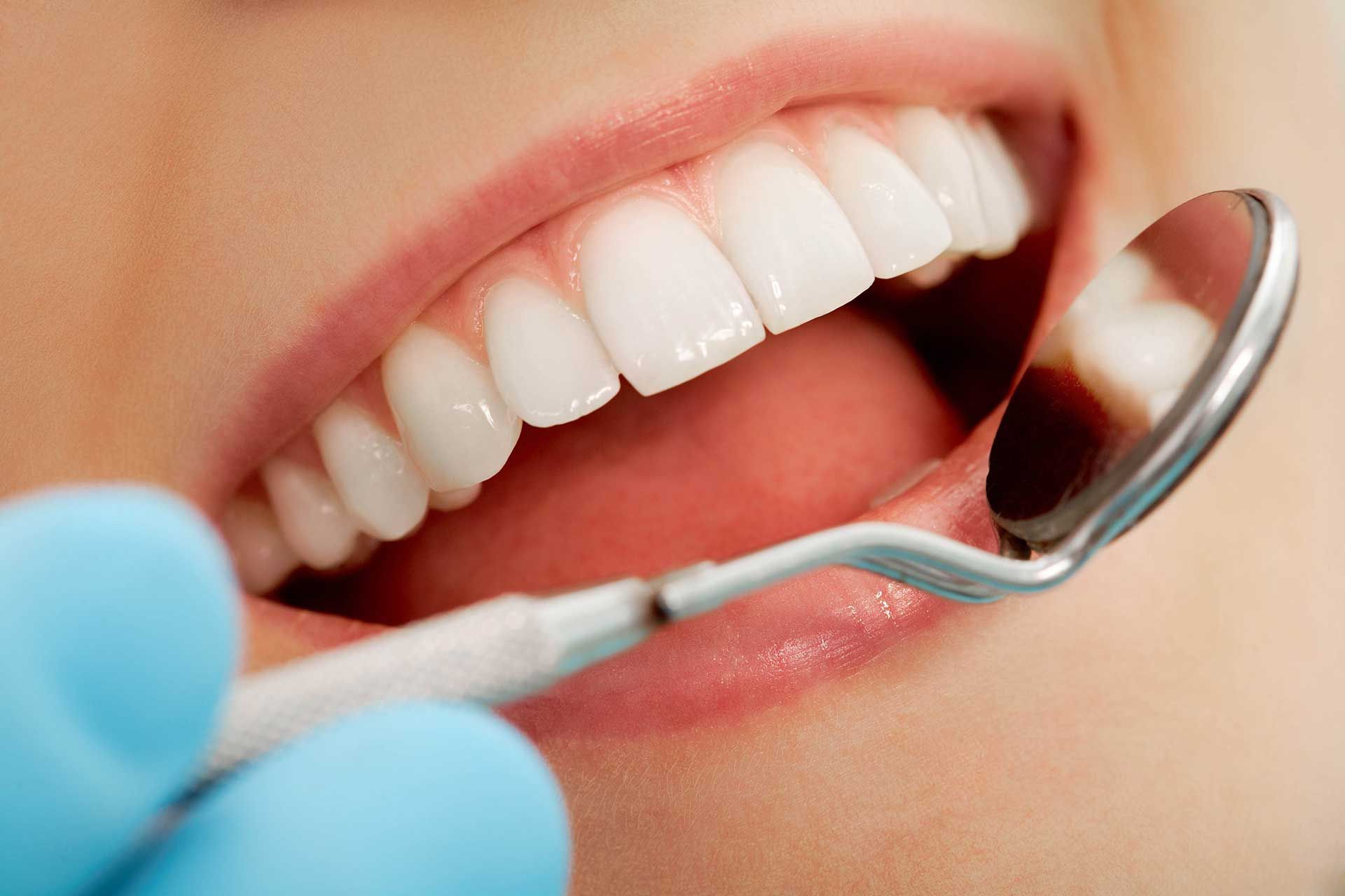 Dentist examining a smiling mouth with a dental mirror and gloved hand