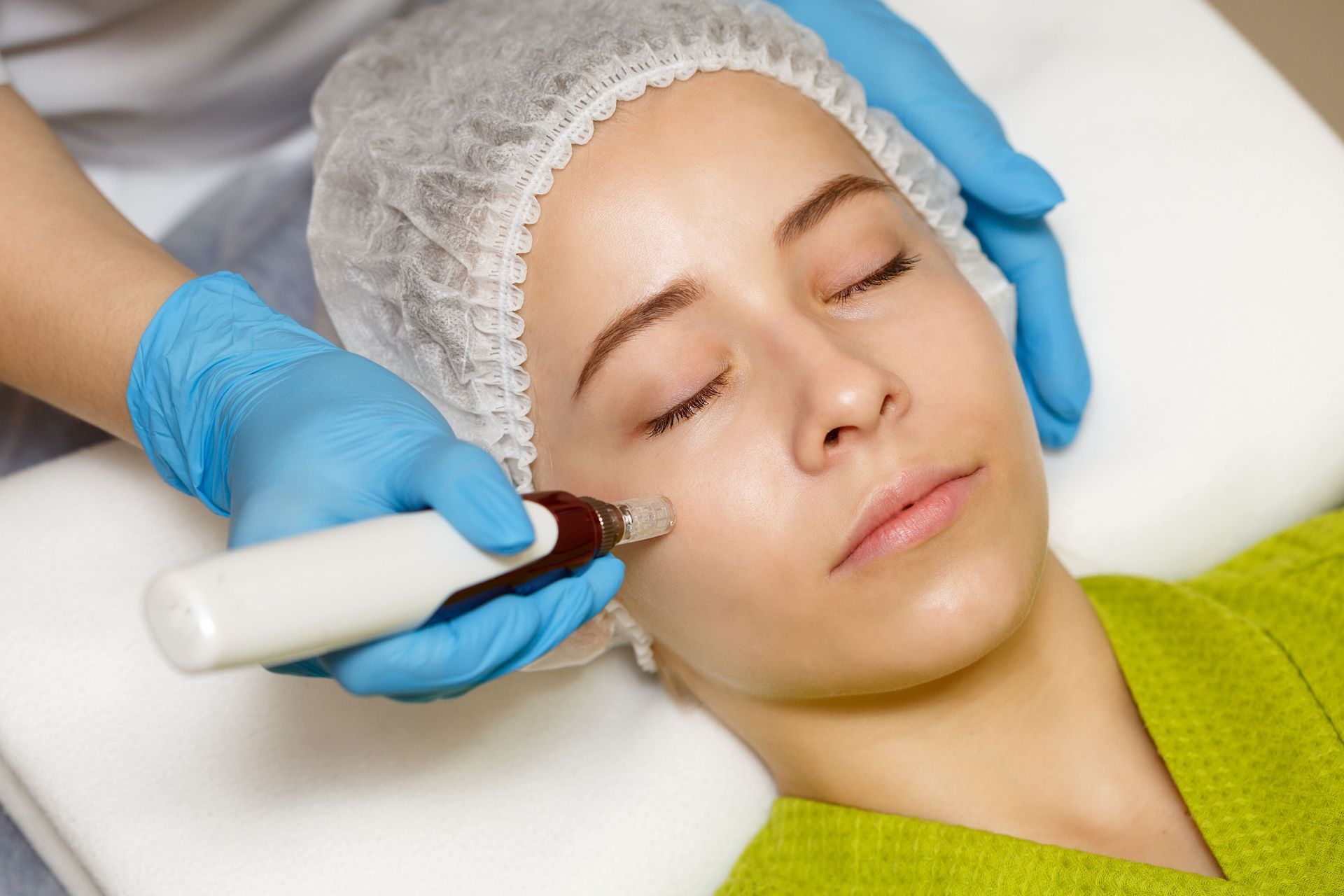 Woman receiving microneedling facial treatment; blue gloved hands hold device on face.