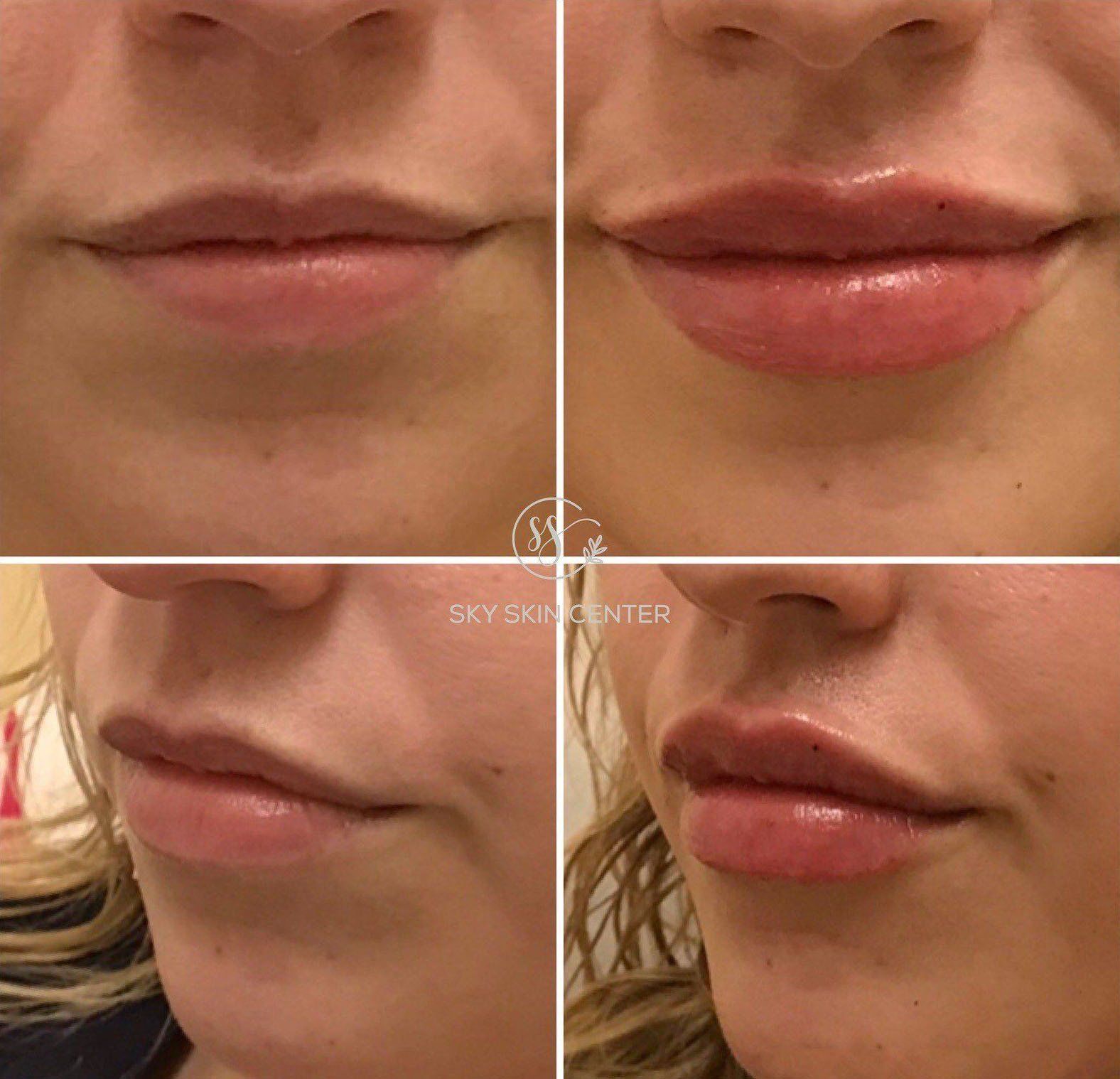 lips