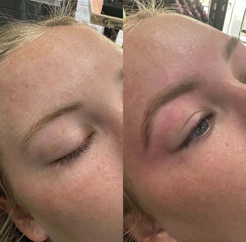 A before and after picture of a woman 's eyebrows.