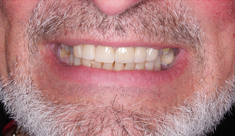 A man with a beard and white teeth is smiling.